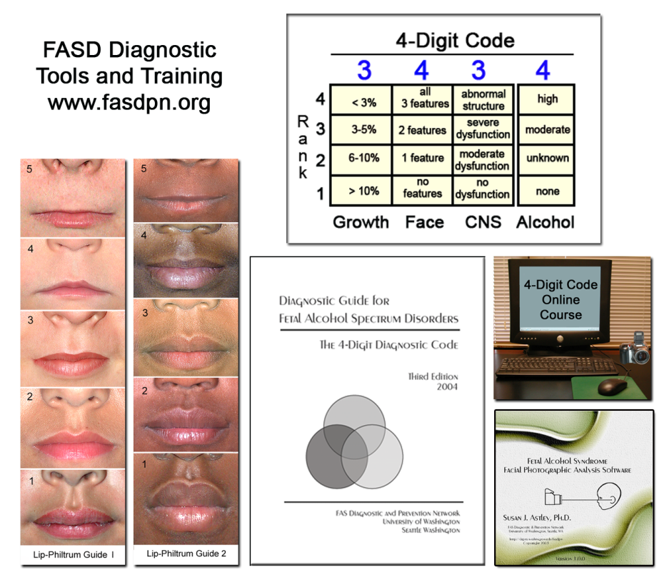 FASD diagnostic tools and training